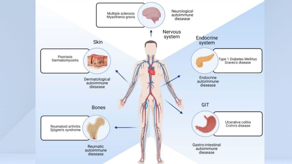 Autoimmunity