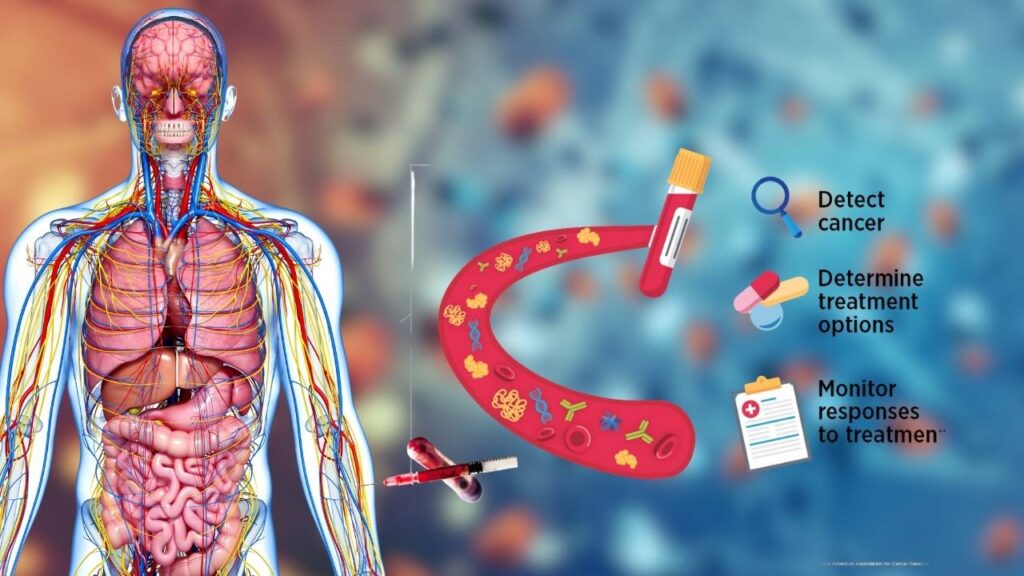 Biopsy
