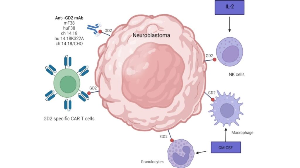 Child Who Received CAR-T Cancer Therapy Remains Disease-Free 18 Years Later 3 CAR-T Targeting GD2 in Neuroblastoma