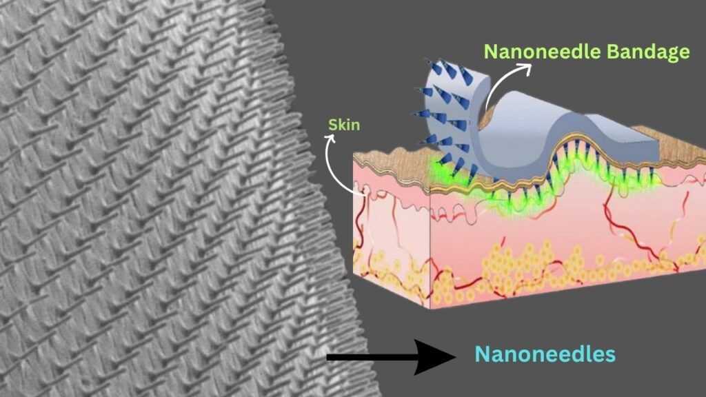 Nanoneedles