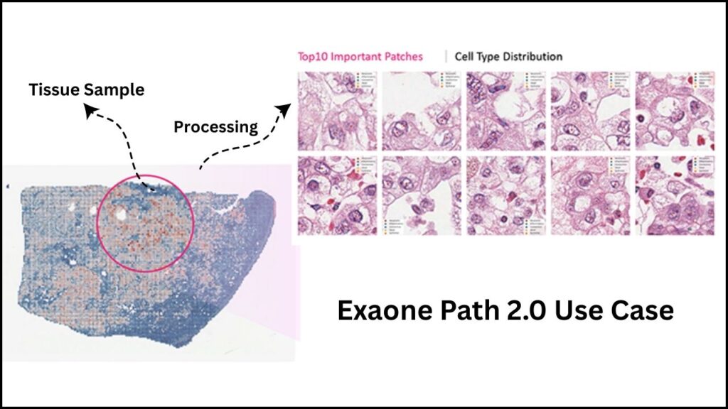 LG’s Exaone Path 2.0 Uses AI to Advance Precision in Genetic Testing 4 How Exaone Path 2.0 Is Used in Clinical Practice