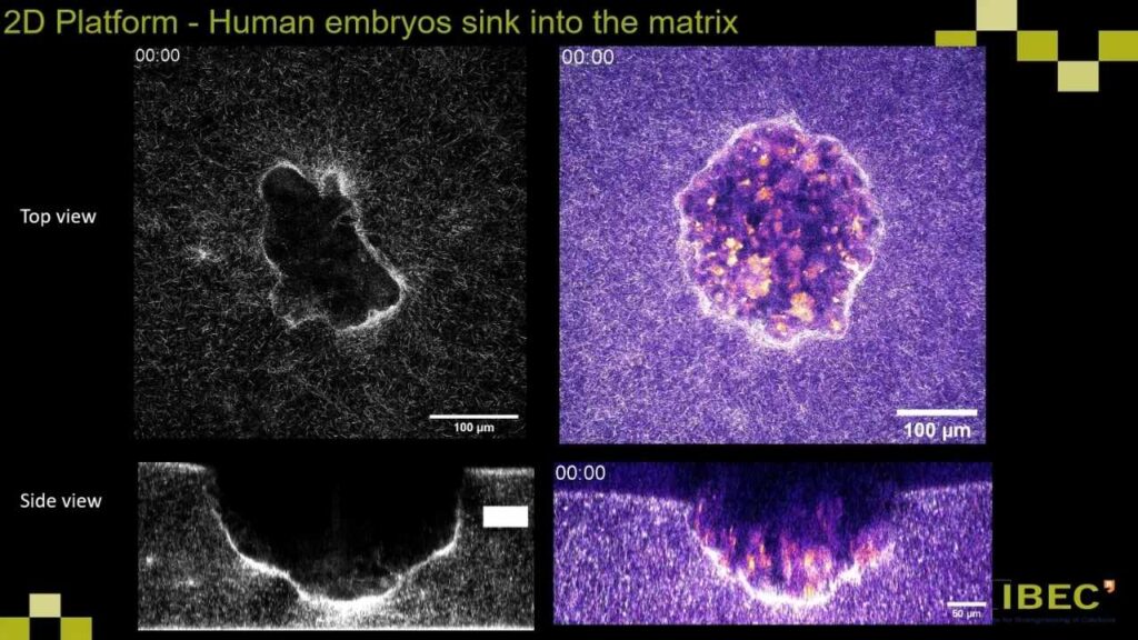 First-Ever Footage Shows Human Embryo Implanting in the Uterus 2 How Scientists Filmed Human Embryo Implantation