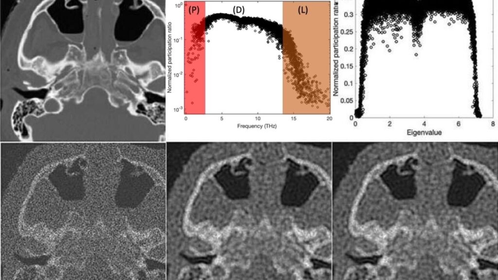 Quantum-Inspired Math Sharpens Noisy Medical Images With Pixel-Particle Analogy