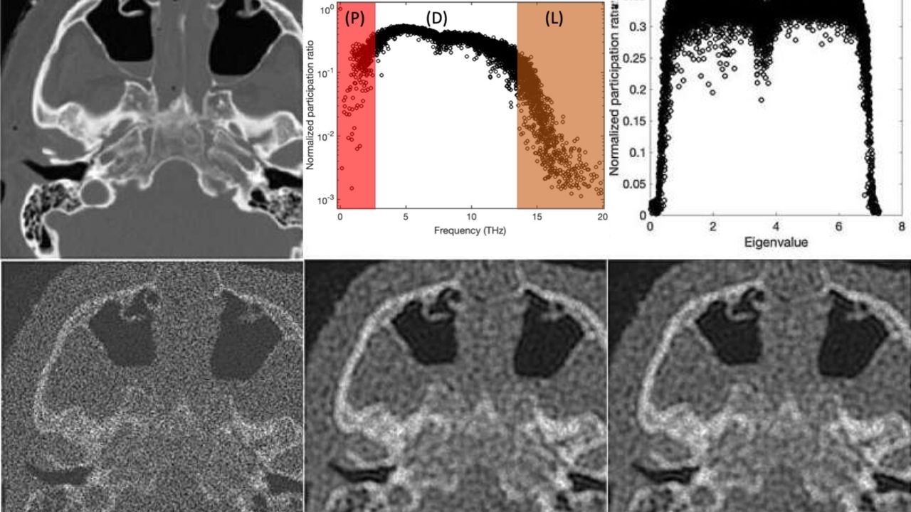 Quantum-Inspired Math Sharpens Noisy Medical Images With Pixel-Particle Analogy